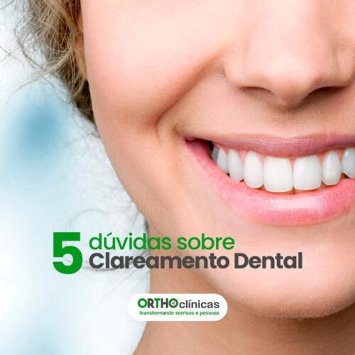 D Vidas Sobre O Clareamento Dental